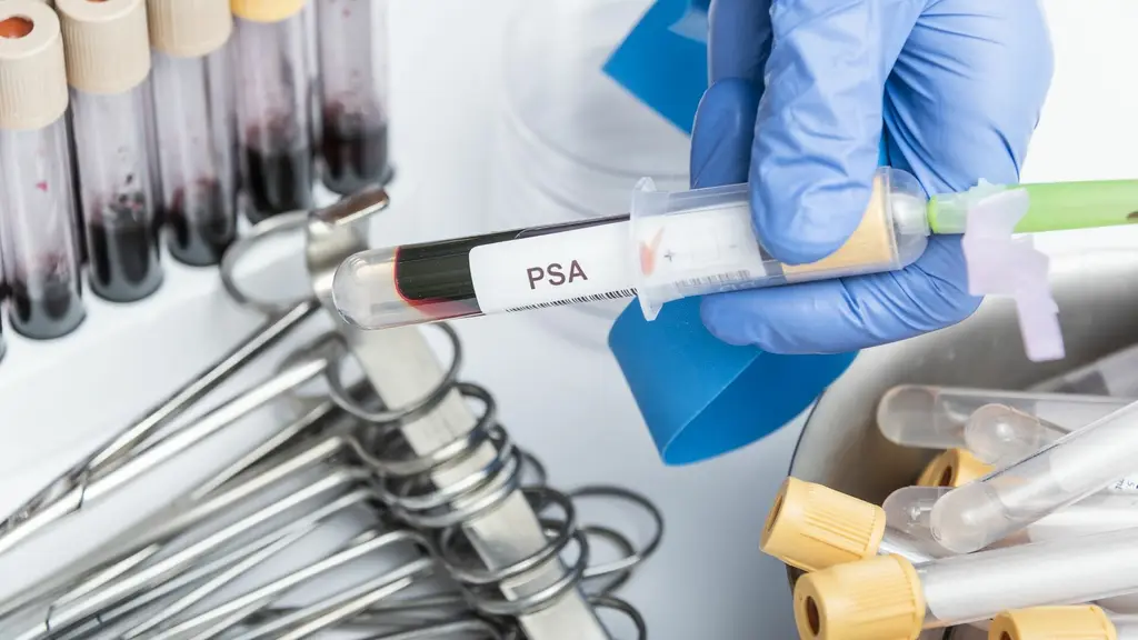 antigeno prostatico cancer de prostata