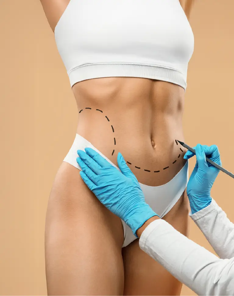 Cirugías de reconstrucción abdominal con Bono PAD crecen más de un 30% en el país