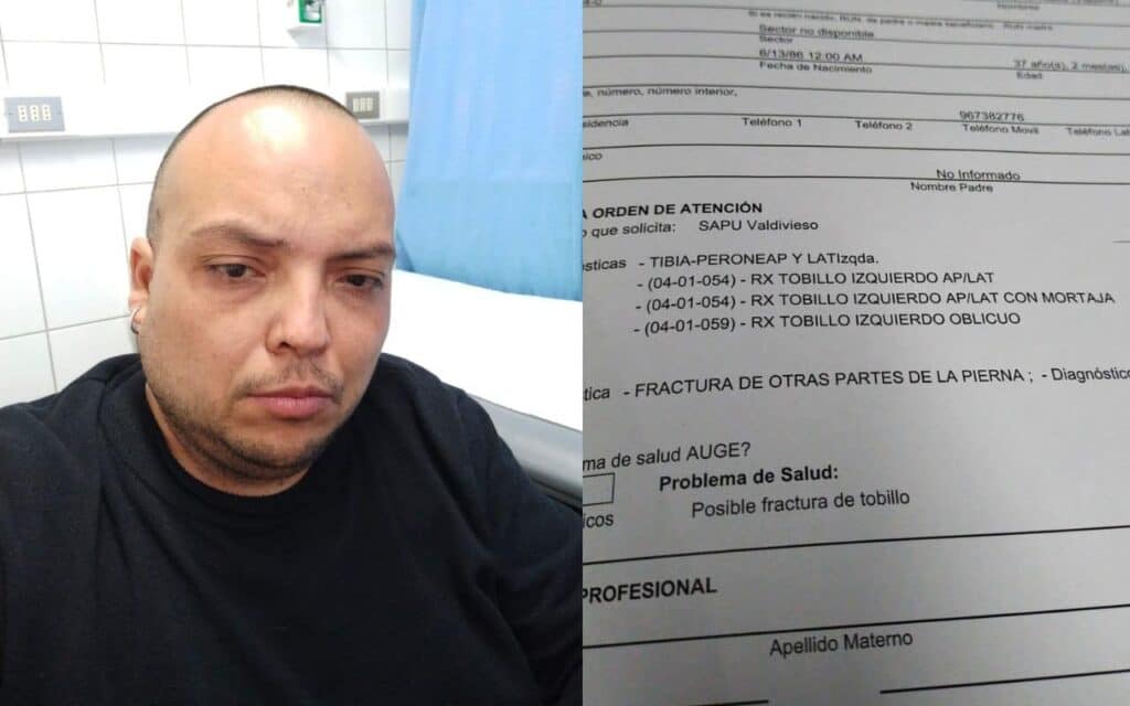 #50Años: Audiovisual maipucino es fracturado por el «guanaco» mientras trabajaba para TeleSur