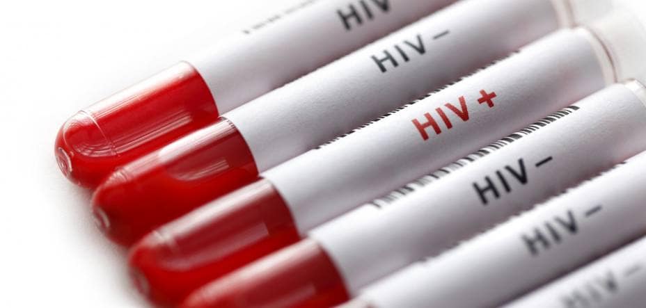 Por gran interés de la comunidad se volverá a repetir la jornada de test rápidos para detectar el VIH