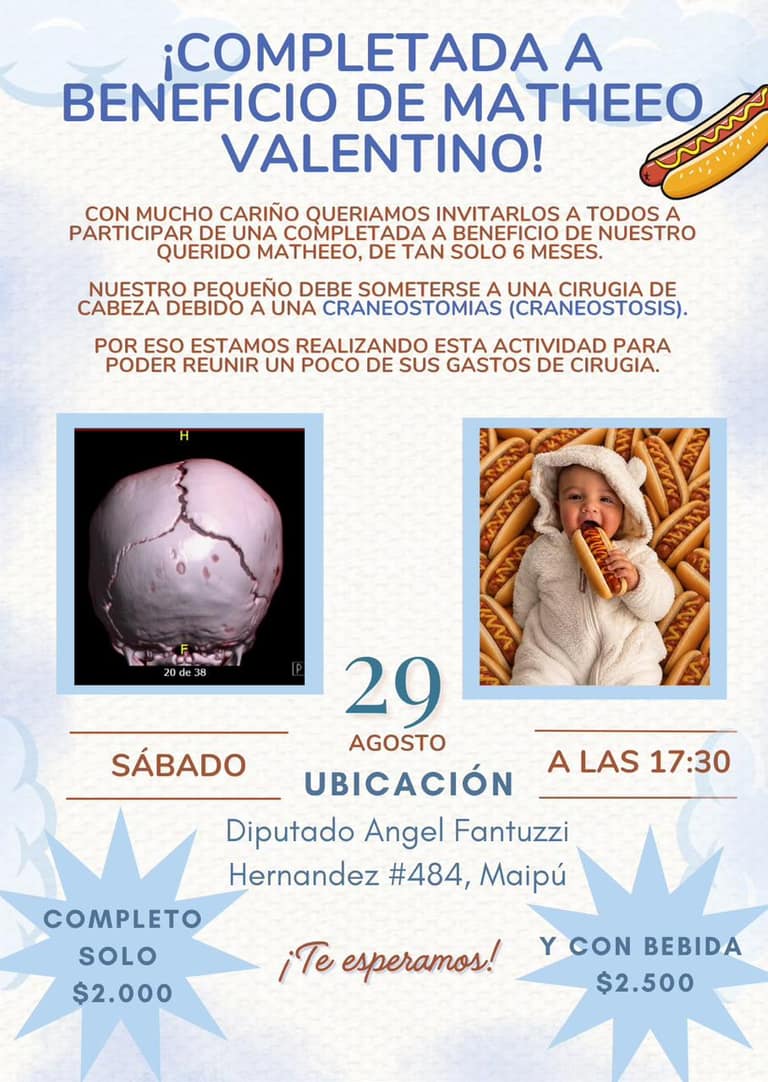 Familia maipucina inicia cruzada solidaria para costear urgente cirugía craneal de bebé de 6 meses