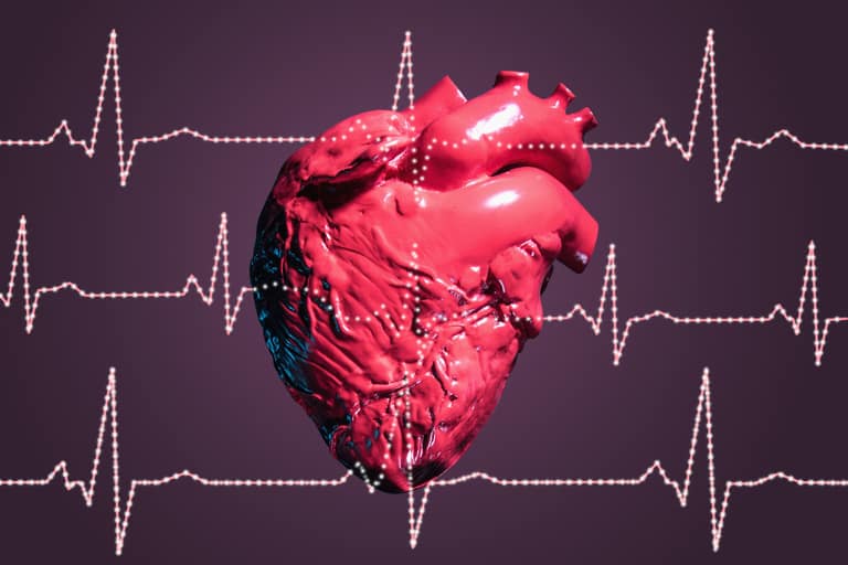Paro cardiaco en Maipú