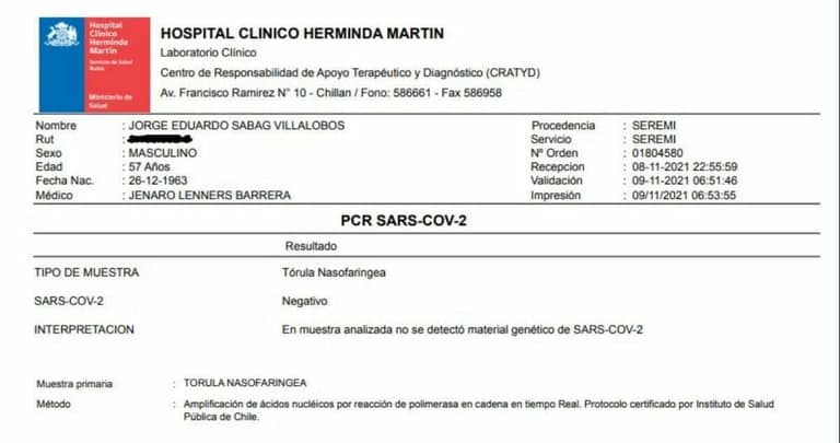 PCR diputado Jorge Sabag revelado en la mañana de este martes.