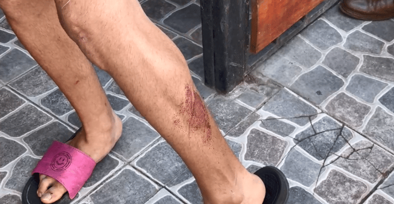 intento de robo a ciclista