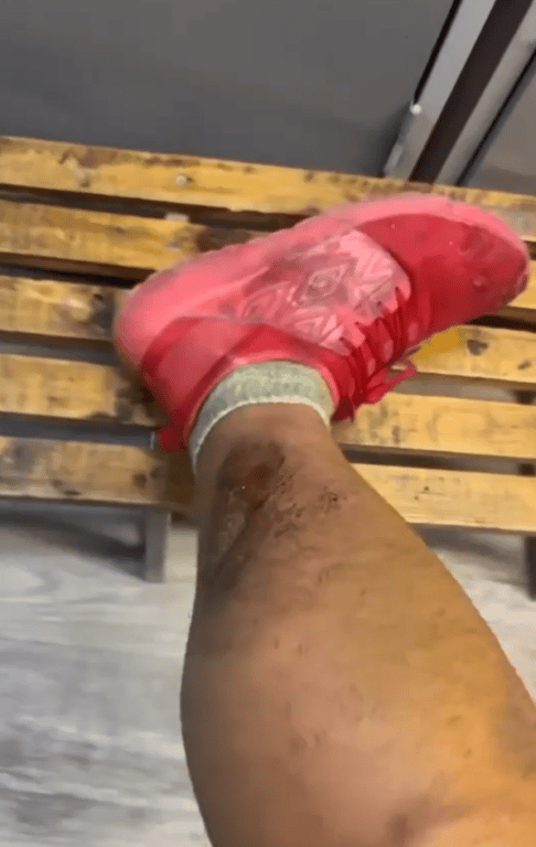 intento de robo a ciclista