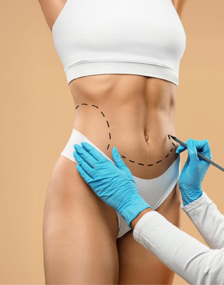 Cirugías de reconstrucción abdominal con Bono PAD crecen más de un 30% en el país