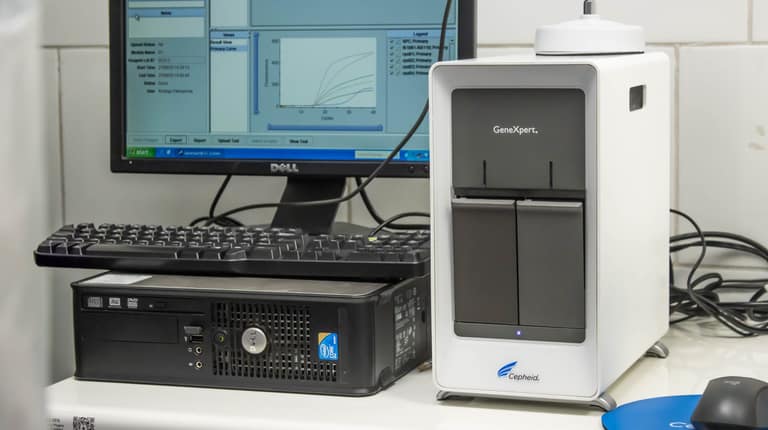 tecnología GeneExpert en el Hospital El Carmen de Maipú
