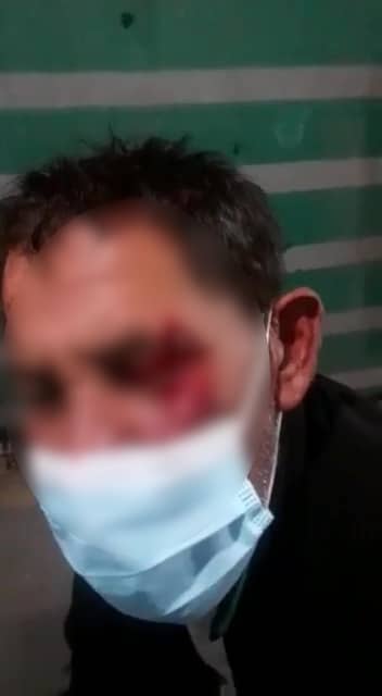 Rostro de uno de los usuarios después del ataque con la botella