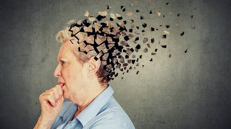 alzheimer 1
