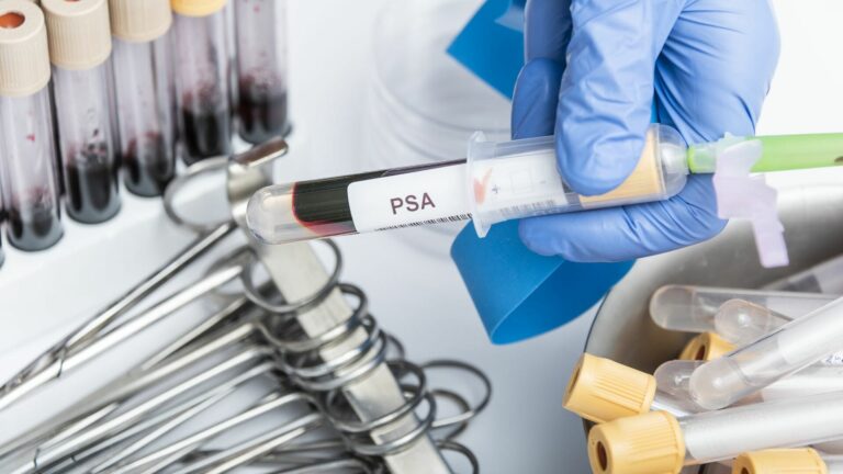 antigeno prostatico cancer de prostata