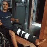 Lucas osteosarcoma
